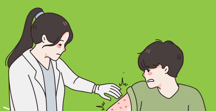psoriasis